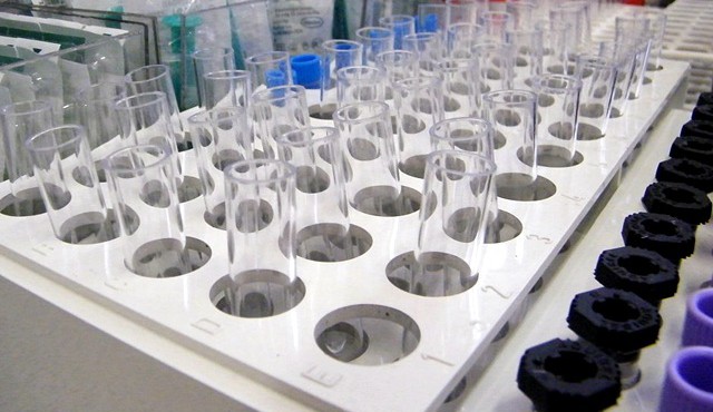 Biomed kupił 130 tys. litrów polskiego osocza