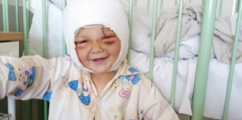 Dziecko pogryzione przez psa / pomagam.pl