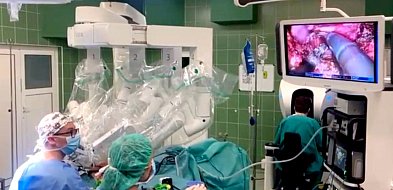 Szpital pokazał nagranie z operacji nowym robotem chirurgicznym [WIDEO]
