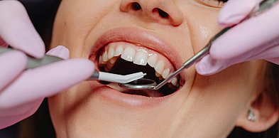 Recesja dziąseł - cichy problem, który może kosztować Cię uśmiech