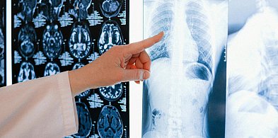 Nowe RTG w szpitalu pozwoli na coś, co dotychczas było niemożliwe