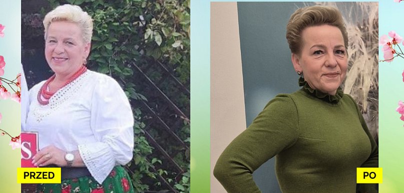 21 kilogramów mniej z Projekt Zdrowie - historia Pani Agaty