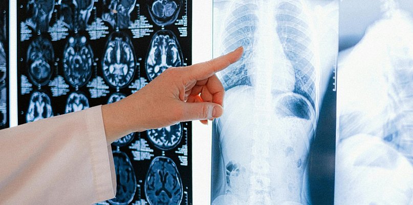 Nowe RTG w szpitalu pozwoli na coś, co dotychczas było niemożliwe