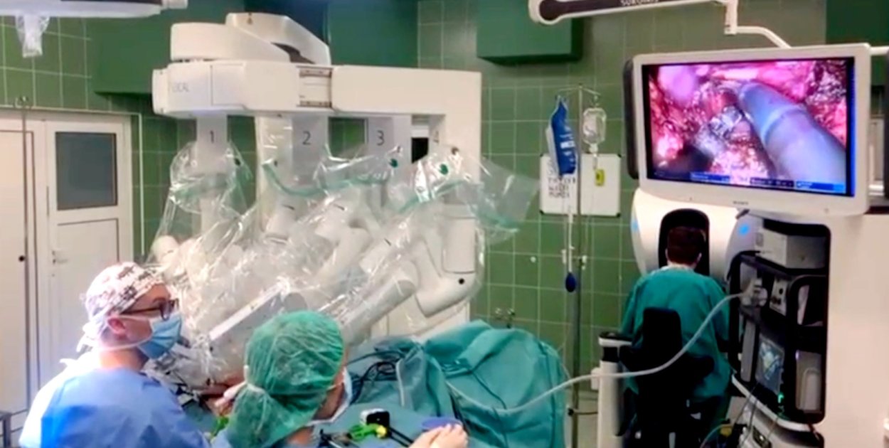 Szpital pokazał nagranie z operacji nowym robotem chirurgicznym [WIDEO]